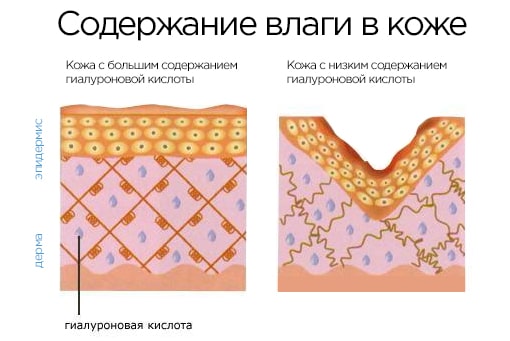 ГК в коже-min.jpg