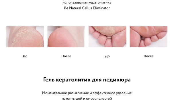 Be_Natural натоптыши 1