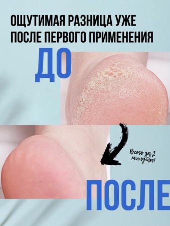 BeNatural Средство для удаления натоптышей Callus Eliminator 29мл